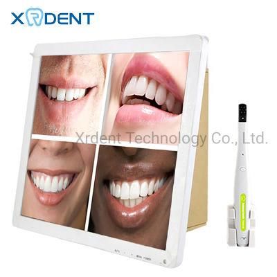 17 Inch LCD Monitor Dental Intraoral Camera Dental Diagnostic Equipment Factory Wholesale