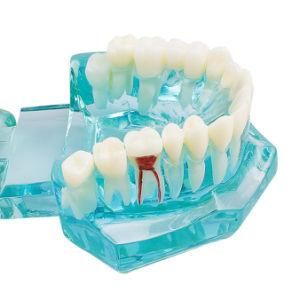 Tooth Model Mold Teeth Standard Denture (Doctor-Patient Communication Oral Decoration)