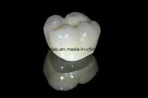 Dental Material Lab Implant Dental Lab Custom Full Contour Zirconium Crown Without Porcelain