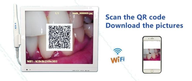 Scan Qr Code to Share Pictures Intraoral Camera