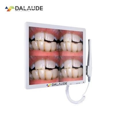 Dental Equipment Integration HD Intraoral Camera