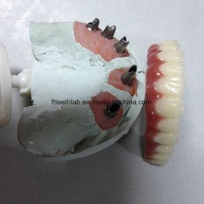 Full Arch Zirconia Implant Bridge From China Dental Lab