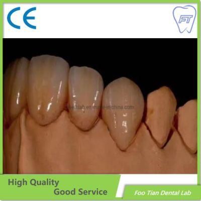 Dental Product Zirconium Crown Custom Dental Material Lab Implant Full Contour Without Porcelain