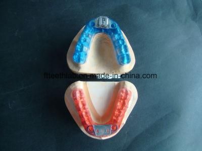 Comfortable Anti-Snoring Appliance Made in China Dental Lab From Shenzhen China