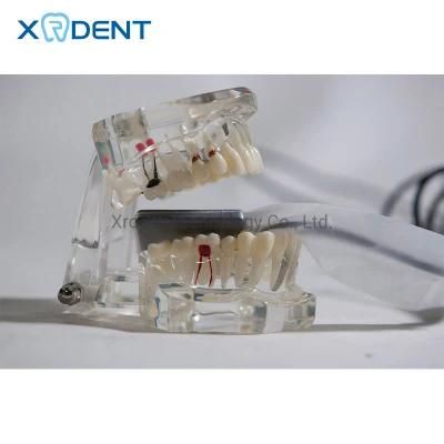 USB Cable Dental Digital Rvg Sensor Unit X-ray Imaging System Connected with Portable X Ray Machine