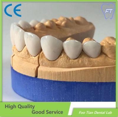 Good Product Emax Dental Inlays and Crowns with High Aesthetic Customized