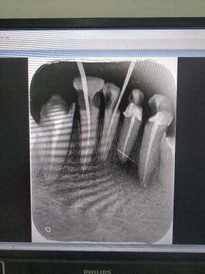 Good Quality Portable Dental X-ray Dental X Ray Camera