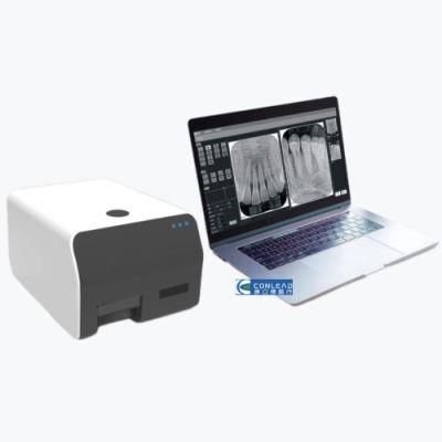 High-Resolution Dental Image Plate X-ray Scanner