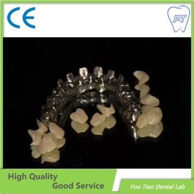 Good Product Removable Solid Titanium Casting Framework Customized