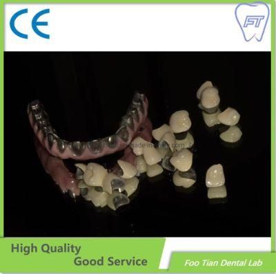 Dental Implant Dental Lab Custom Full Contour Zirconium Crown Without Porcelain