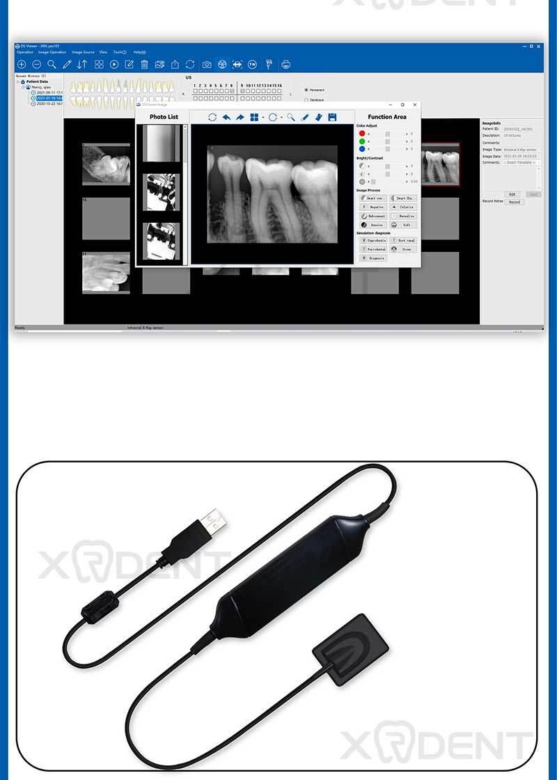 Factory Price USB Digital Dental X-ray Sensor Rvg Dental