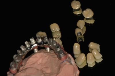 Dental Material Lab Implant Dental Lab Custom Malo Bridge