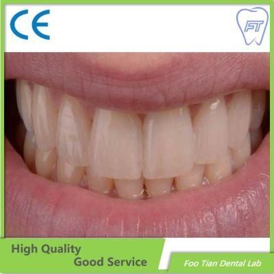 Promotional Denture Zirconia Crown with High Aesthetic and Natural Customized