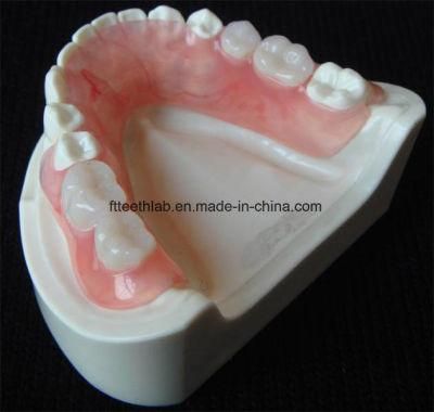 Valplast Dentures Removable Partial Denture