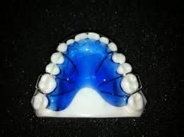 Dental Hawley Retainer From Dental Laboratory
