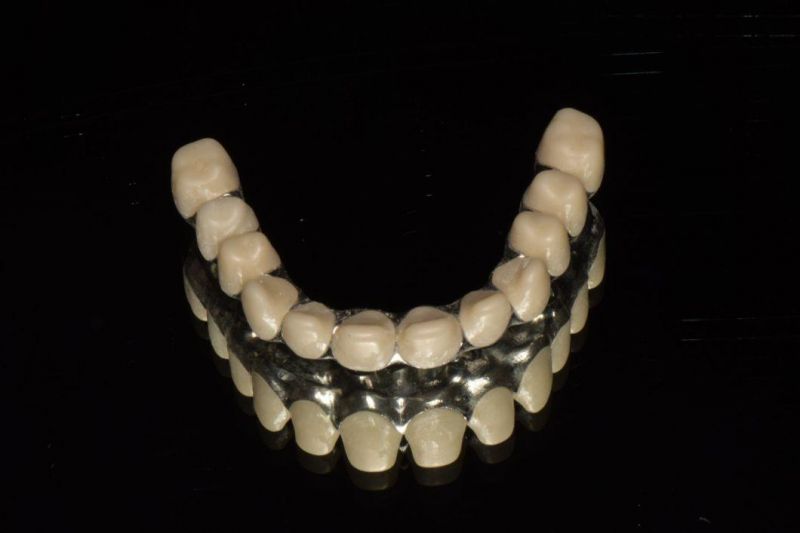 Dental Material Lab Implant Dental Custom Abutments Compatible with Nobel, Straumnn, Dentium, Mis, Astra Tech, Zimmer, Dio, Osstem