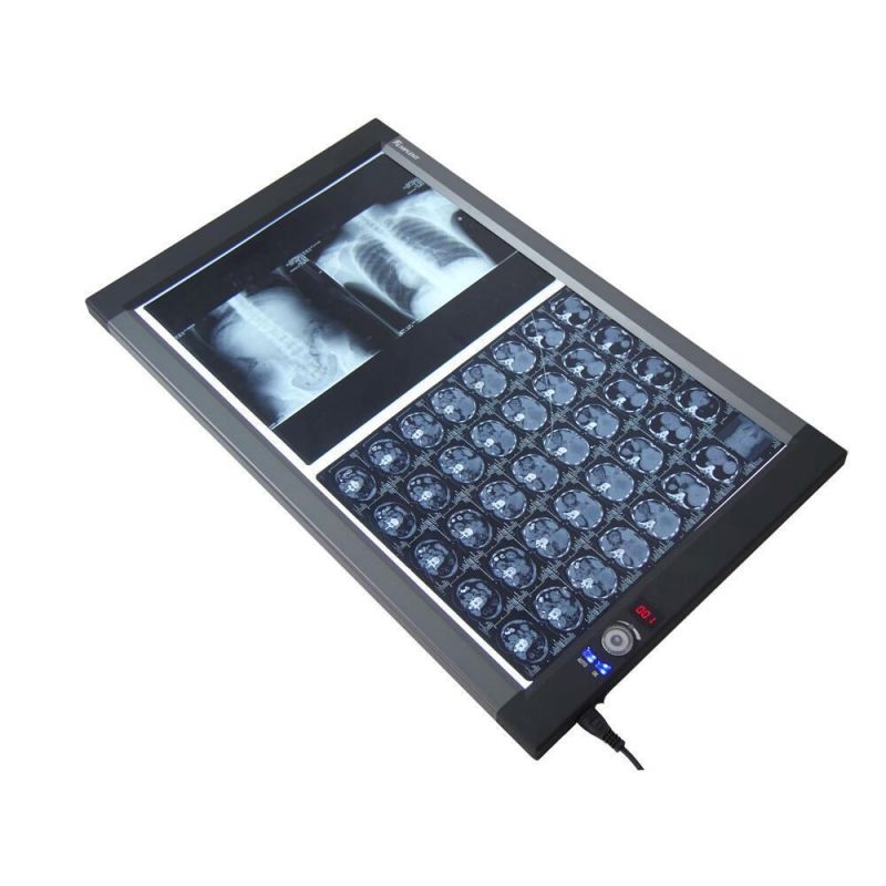 Dental X Ray Film Illuminator X-ray Film Viewer for Dentistry