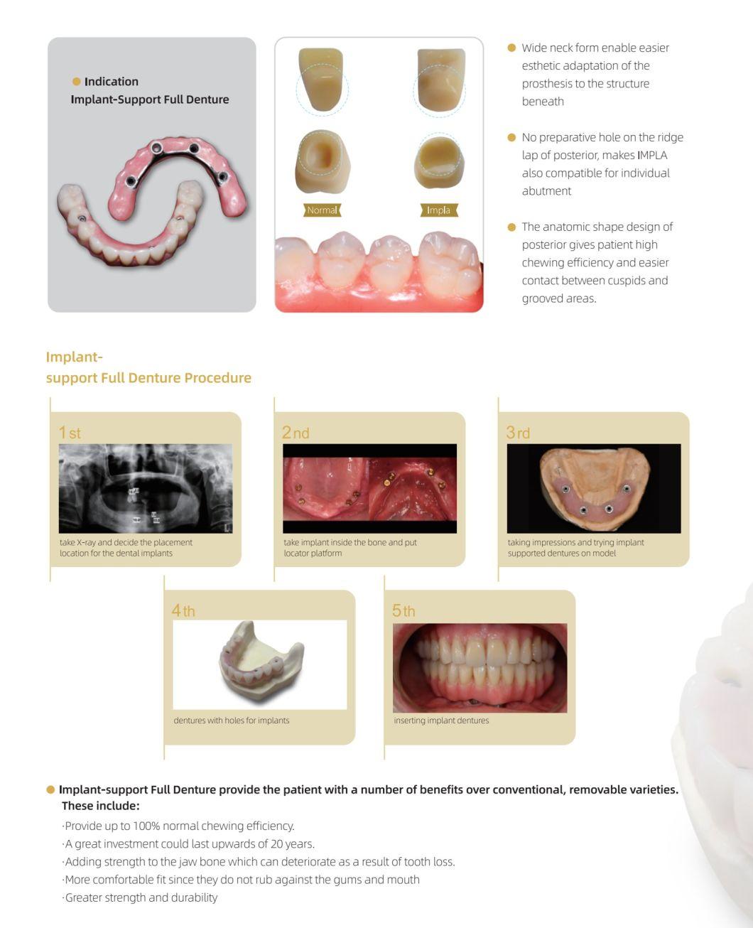 High Quality Five Layers Impla Shandong Huge Full and Removable Implant-Support Full Denture Acrylic Resin Practical False Teeth