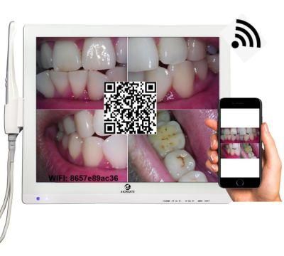 2MP High Pixel Digital Dental Intraoral Camera with 17 Inch Multimedia Monitor