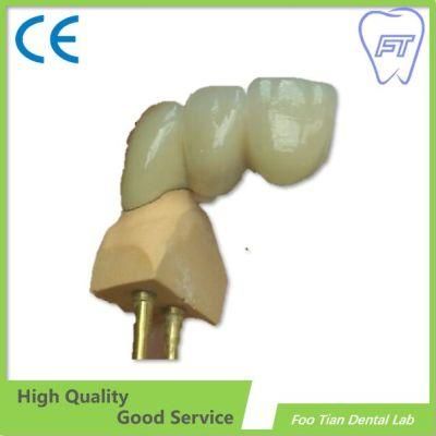 Manufacture Bruxzir Solid Stable Zirconia Bridge From China Dental Lab on Selling