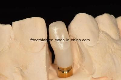 Zirconia Customized Abutments for Dental Implants From China Dental Lab