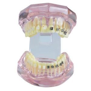 Standard Dental Model Teeth Typodont Nissin Adult/Children 28/32PCS (Dental Education Use)