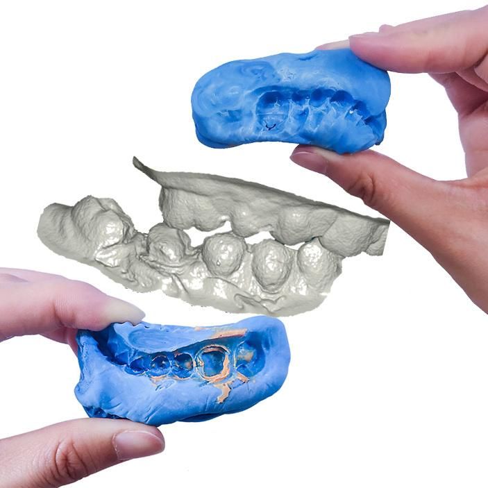 Manufacturer CAD/Cam 3D Scanner Dental Lab Price with Exocad