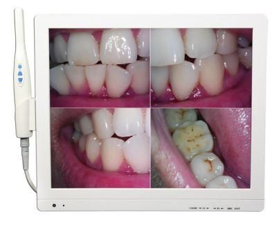Dental Equipment 17 Inch Dental Intraoral Camera Intraoral Camera with LCD Screen