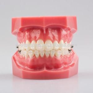 Orthodontic Dental Clear Ceramic Bracket with Orthodontic Typodont