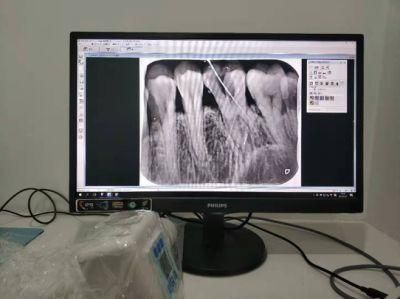 Dental Portable X Ray Unit Machine Dental Clinic Best Cost-Effective X-ray Machine