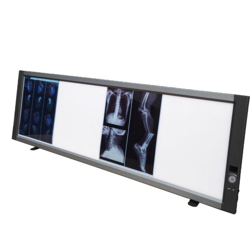 Dental X Ray Film Illuminator X-ray Film Viewer for Dentistry