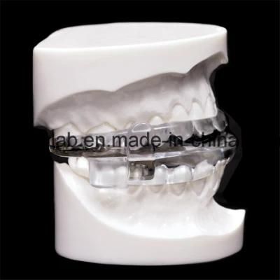 Dental Anti-Snoring Device Made in China Dental Lab From Shenzhen China with High Aesthetic