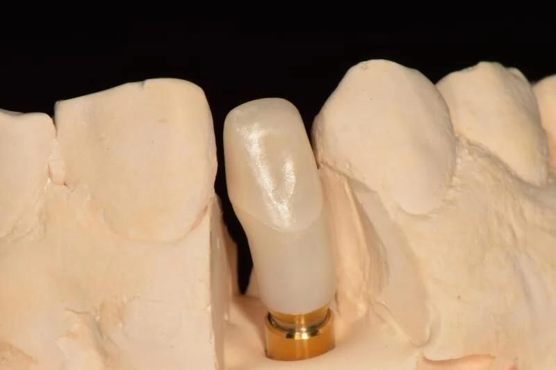 Dental Material Lab Implant Dental Lab Custom Zirconia Implant Abutments Used for Implant Cases
