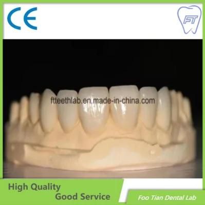 Dental Material Supplies Crown Dental Lab Orthodontic Products Natural Ultra Thin Veneers for Perfect Smile