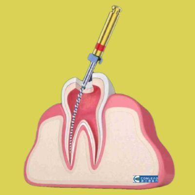China Top Rated Dental Endodontic Root Canal Files