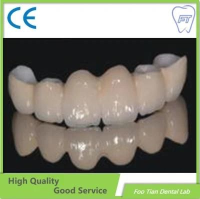 Zirconia Crown and Bridge Made From China Dental Lab with High Aesthetic and Natural Looking