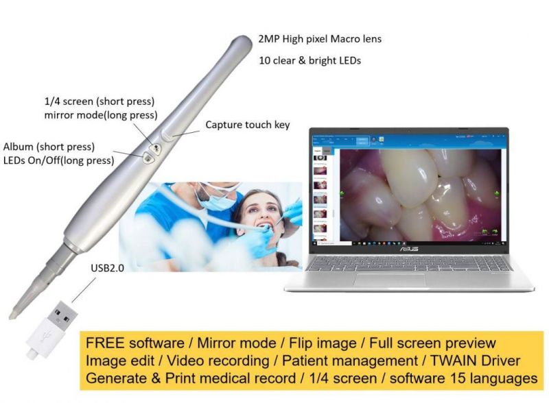 Portable Macro Lens 720p CMOS Dental Intraoral Camera USB Port