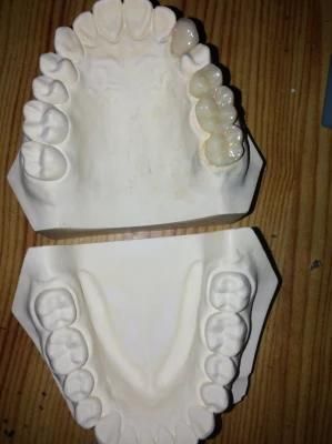 Dental Material Lab Implant Dental Lab Custom Bruxzir Solid Zirconium Crowns and Bridge From China Dental Lab