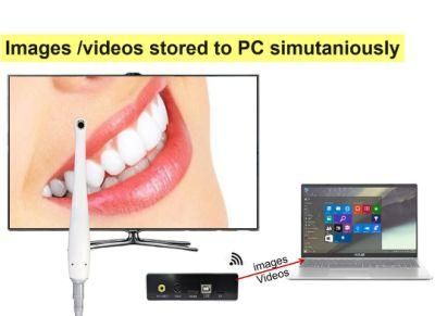 Portable TV Intraoral Camera Metal Case with 2MP Macro Lens Super Clear Image