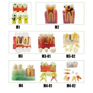 Medical Anatomy Model Dental Human Tooth Model Human Demo Teeth Model