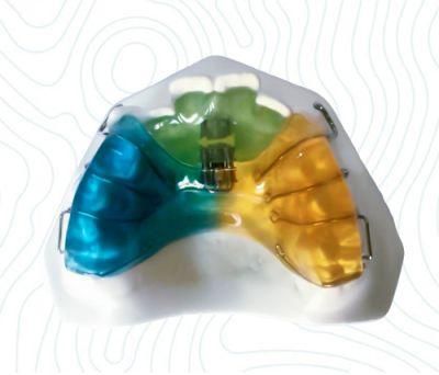 Dental Twin Block Appliance From Midway Dental Lab