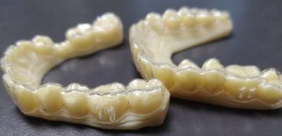 Teeth Aligners Cost/Cheapest Teeth Aligners/Jaw Alignment Braces/Essix Retainer with Tooth
