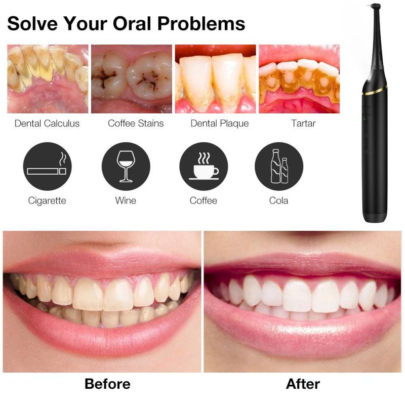 Wholesale Water Flosser Tap for Oral Health Cleaner Noiseless Teeth Cleaning Dental Water Flosser Teeth Cleaning Device