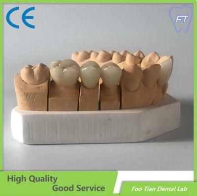 OEM Bridge and Zirconium Crown Custom Dental Material Lab Implant Full Contour Dental Implant