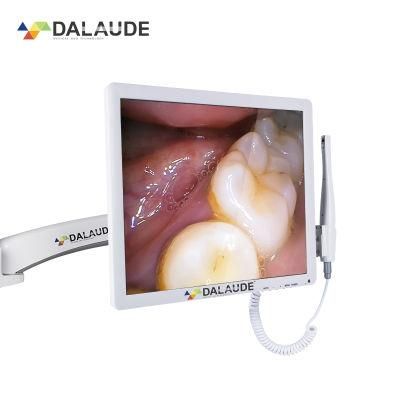 China Golden Suppliers Small Size HD Lenses Dental Camera for Dentist