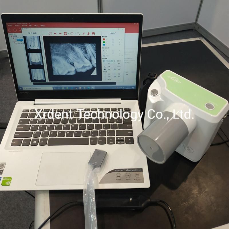Long Tube 70kv 2mA Portable Dental X Ray Dental Equipment