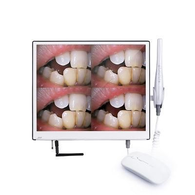 2022 Ultra Monitor with Intraoral Camera, High Quality and 10 Megapixels