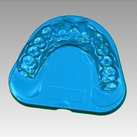 Manufacturer CAD/Cam 3D Scanner Dental Lab Price with Exocad