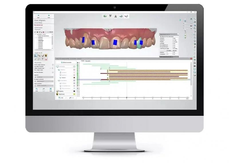 OEM Teeth Aligner Dental 3D Clear Aligners Orthodontics Brace with Quality Certifications