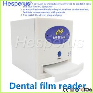 Dental X-ray Film Reader